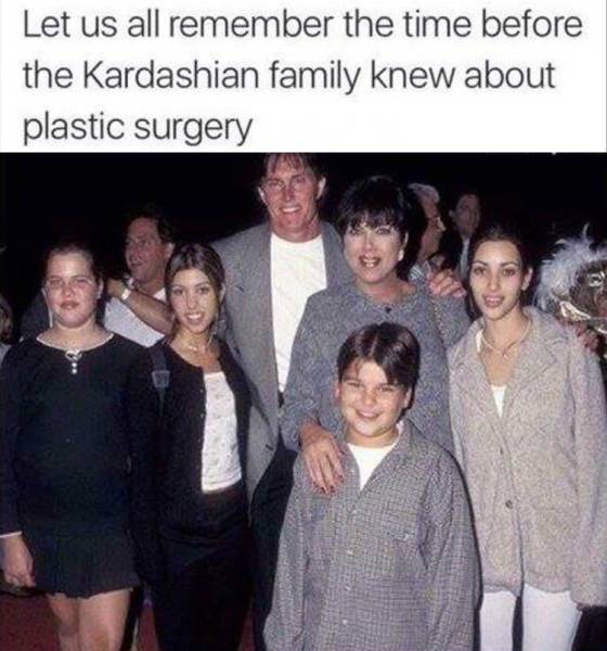 Before the Kardashian family discovered plastic surgery.