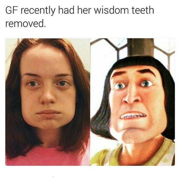 GF recently had her wisdom teeth removed.