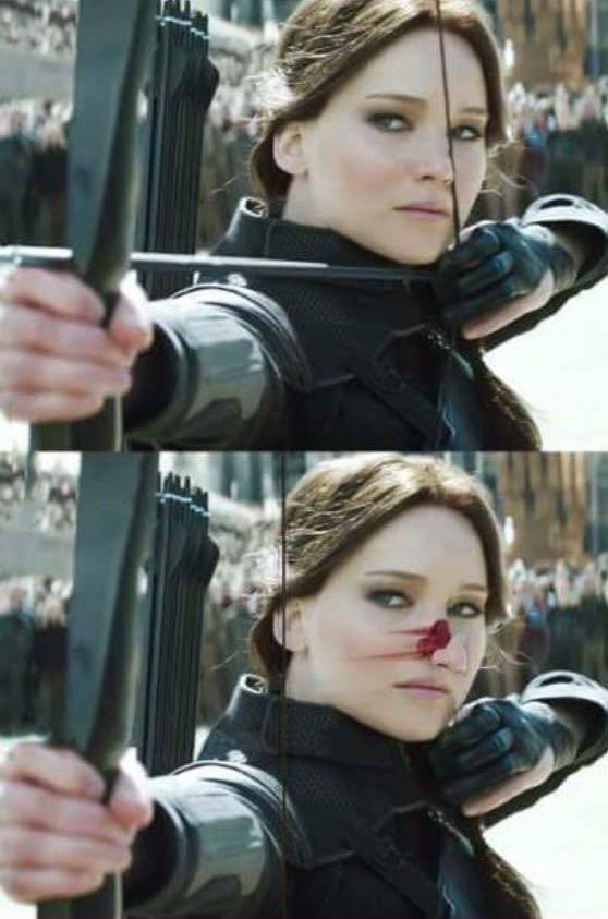 If you shoot a bow and arrow incorrectly, this could be you.