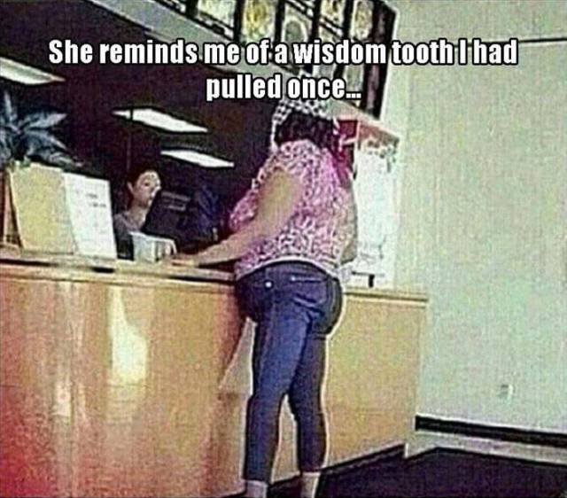 She reminds me of a wisdom tooth I had pulled once.