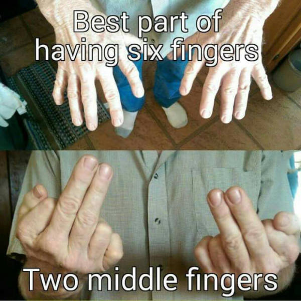 The best part of having six fingers.