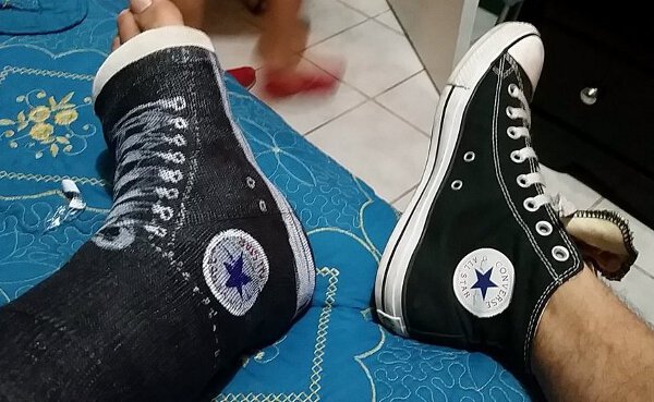 This Guy Made The Best Of Having A Cast On His Leg. Converse Chuck Taylor All Stars Will Never Go Out Of Style.