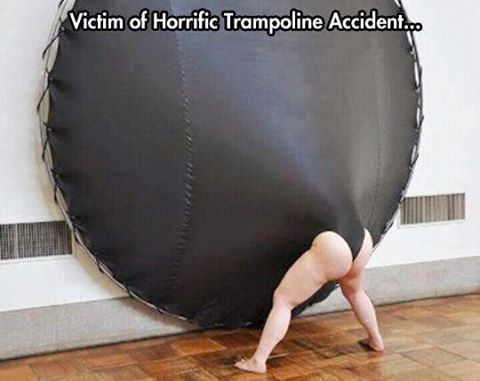 Trampoline Accident Causes One Hellacious Wedgie.