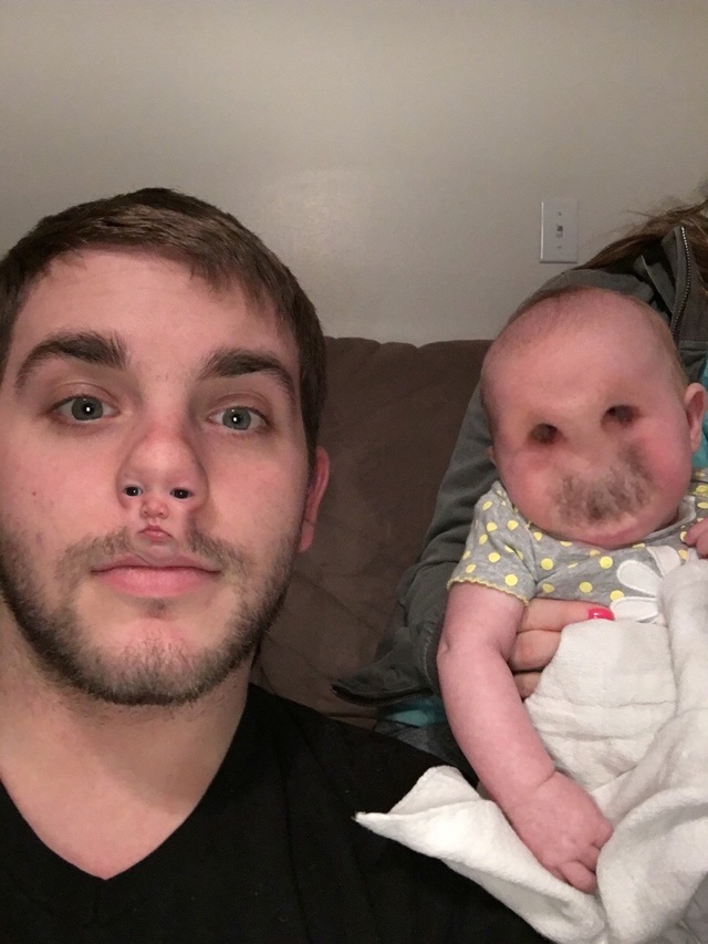Father and baby daughter face swap gone wrong.