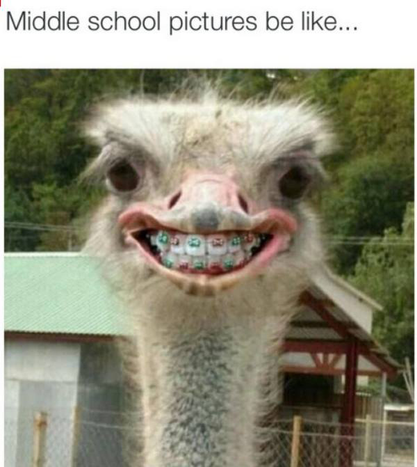 Middle school pictures and braces go hand in hand.
