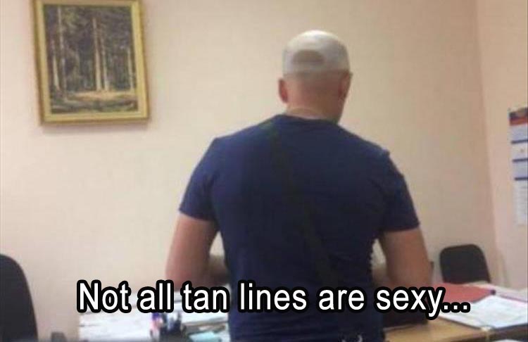 Not all tan lines are sexy.