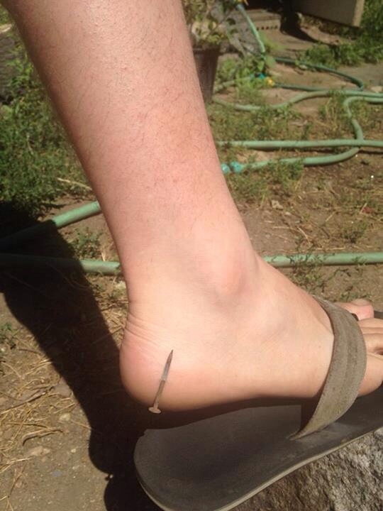 This Lucky Guy Just Narrowly Escaped A Rusty Nail Going Into His Foot And Possibly Getting The Dreaded Thing Your Parents Always Warned You About....LockJaw!