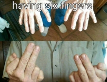 The best part of having six fingers.