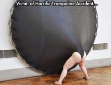 Trampoline Accident Causes One Hellacious Wedgie.