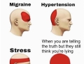 Types of headaches.