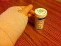 Wrist surgery and pain medication.