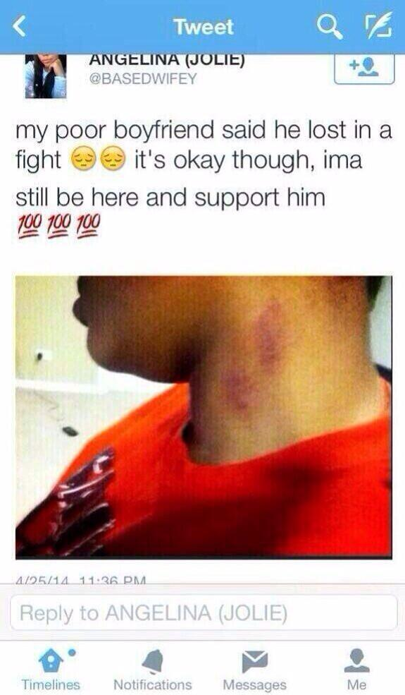 Guy comes home with hickeys on his neck and tells his girlfriend he got in a fight. She then tweets about it.