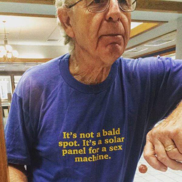 It's not a bald spot. It's a solar panel for a sex machine.